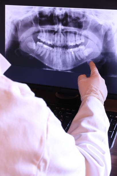 Best Emergency Dental Care for Broken or Chipped Teeth in Woodbridge, VA